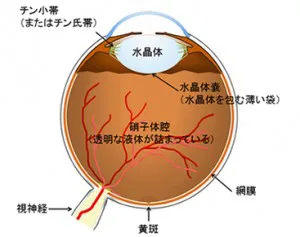 白内障手術 | 中島眼科